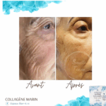 Forever Marine Collagen thumbnail 2